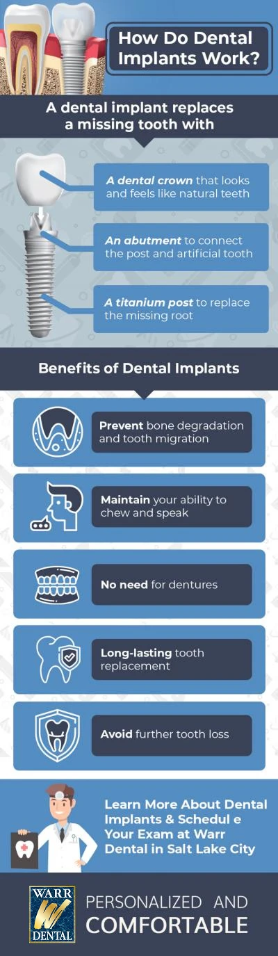 Graphic for Dental Implants in Salt Lake City, UT